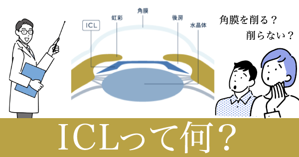 ICLって何？どうして視力がよくなるの？疑問にお答えします！